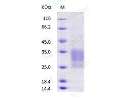 Sino Biological Human CD79 (CD79A & CD79B Heterodimer) Protein (FLAG &