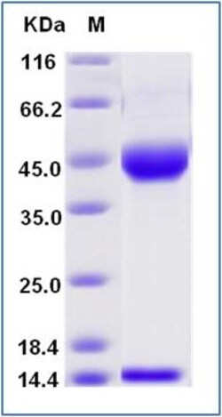 Sino Biological Recombinant Mouse FCGRT & B2M Heterodimer Protein (His