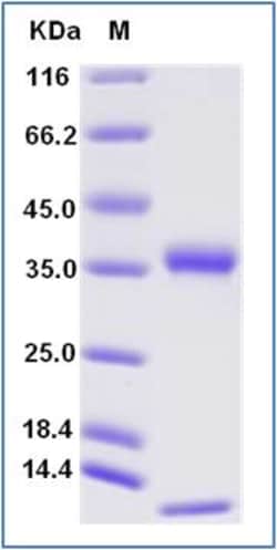 Sino Biological Cynomolgus FCGRT & B2M Heterodimer Protein (His & AVI Tag),
