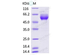 Sino Biological Human IL15RA & IL-15 (N120D) Heterodimer Protein (Fc Tag)