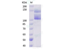 Sino Biological Recombinant Human Integrin alpha V beta 3 Protein (His
