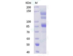 Sino Biological Recombinant Human Integrin alpha V beta 8 Protein (His