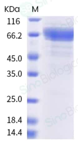 Sino Biological Recombinant Human IL-35 Protein (Fc-Flag & Fc-His Tag),