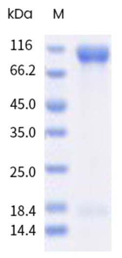 Sino Biological&nbsp;Varicella-zoster virus (VZV) (strain Oka vaccine) gH & gL Heterodimer Protein, Biotinylated (MALS-verified) 20