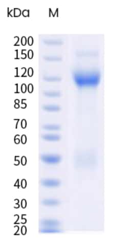 Sino Biological&nbsp;Recombinant Mouse Integrin alpha 3 beta 1 Protein (Flag & His Tag), HPLC-verified 1 mg