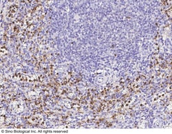Sino Biological Anti-Cathepsin G/CTSG Antibody, Rabbit Polyclonal, Quantity: