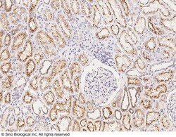 Sino Biological Anti-CDP/CUX1 Antibody, Rabbit Polyclonal, Quantity: Each