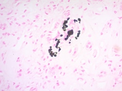 Scytek Laboratories Calcium Stain Kit (Modified Von Kossa): Small, Quantity: