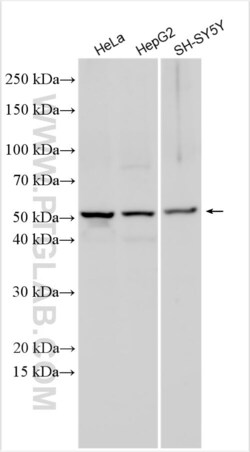 CXCL16 Rabbit, anti-Human, Polyclonal, Proteintech Quantity: 20 &mu;L:Antibodies
