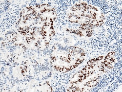 Sino Biological p53 / TP53 Antibody, Rabbit MAb 100µL, Quantity: Each of