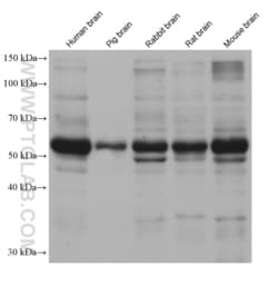 CYP46A1 Mouse, anti-Human, Clone: 1E10D3, Proteintech Quantity: 150 &mu;L:Antibodies