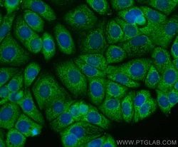 CYR61 Mouse, anti-Human, CoraLite Plus 488, Clone: 2E11F11, Proteintech 100 &mu;L | Buy Online | Proteintech | Fisher Scientific