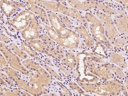 Sino Biological Anti-CYYR1 Antibody, Rabbit Polyclonal, Quantity: Each