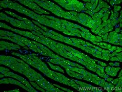 Cardiac Troponin T Rabbit, anti-Human, CoraLite Plus 488, Polyclonal, Proteintech