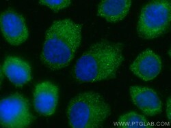 Cytokeratin 1-specific Rabbit, anti-Human, CoraLite Plus 488, Polyclonal,