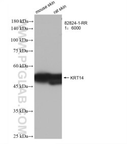 Cytokeratin 14 Rabbit, anti-Human, Clone: 1L19, Proteintech:Antibodies:Primary