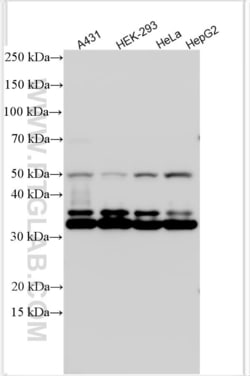 DAPK3 Rabbit, anti-Human, Polyclonal, Proteintech Quantity: 20 &mu;L:Antibodies