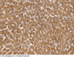 Sino Biological Anti-DAZ Antibody, Rabbit Polyclonal, Quantity: Each of
