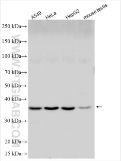 DCPS Rabbit, anti-Human, Polyclonal, Proteintech Quantity: 20 &mu;L:Antibodies