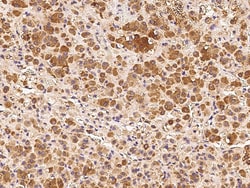 Sino Biological Anti-DDRGK1 Antibody, Rabbit Polyclonal, Quantity: Each