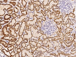 Sino Biological DECR1 Antibody, Rabbit PAb, Antigen Affinity Purified 100µL,