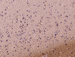 Sino Biological DKK3 Antibody, Rabbit PAb, Antigen Affinity Purified 100uL,