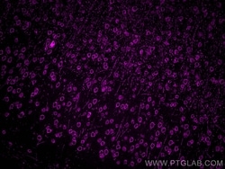 DLL3 Rabbit, anti-Human, CoraLite Plus 647, Polyclonal, Proteintech Quantity: