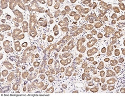 Sino Biological Anti-DPF3 Antibody, Rabbit Polyclonal, Quantity: Each of