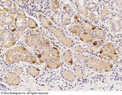 Sino Biological Anti-DPP2 Antibody, Rabbit Polyclonal, Quantity: Each of