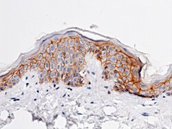 Sino Biological Recombinant Anti-E-Cadherin Antibody, Rabbit Monoclonal,
