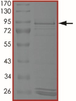 Sino Biological&nbsp;Recombinant Human EGFR Protein (H773_V774insNPH, GST Tag)