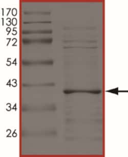 Sino Biological&nbsp;Recombinant Human eIF2alpha/EIF2S1 Protein (Full Length, His Tag)