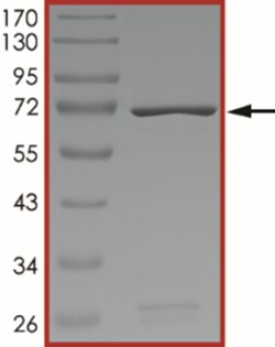 Sino Biological&nbsp;Recombinant Human EphB4 Protein (I782S, GST Tag)