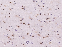 Sino Biological Anti-E2f6 Antibody, Rabbit Polyclonal, Quantity: Each of