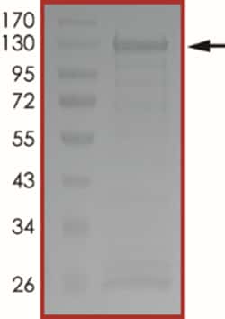 Sino Biological&nbsp;Recombinant Human EZH2/KMT6 Protein (Full Length, Y641S, GST Tag)