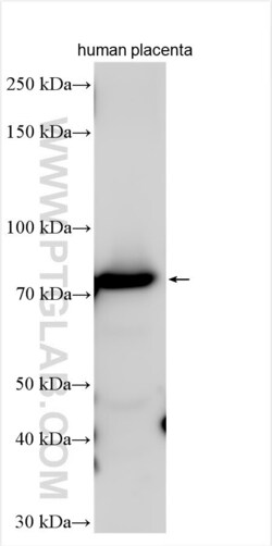 EPB42 Rabbit, anti-Human, Polyclonal, Proteintech:Antibodies:Primary Antibodies