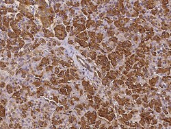 Sino Biological Anti-EphB6 Antibody, Rabbit Polyclonal, Quantity: Each
