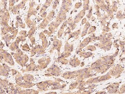 Sino Biological Anti-HER3/ERBB3 Antibody, Rabbit Polyclonal, Quantity: