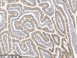 Sino Biological Espin Antibody, Rabbit PAb, Antigen Affinity Purified 100uL,