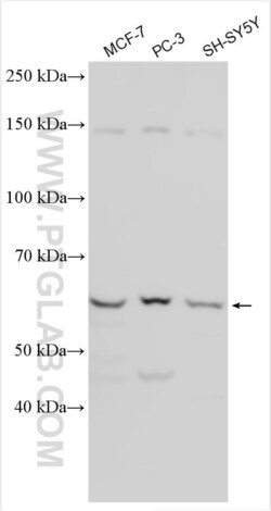 ESR2 Rabbit, anti-Human, Polyclonal, Proteintech Quantity: 20 &mu;L:Antibodies