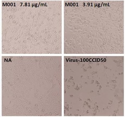 Sino Biological Enterovirus 71 VP4 Neutralizing Antibody 200ug, Quantity: