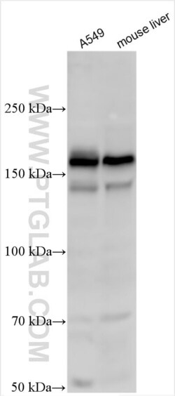 Egfr Rabbit, anti-Human, Polyclonal, Proteintech 150 &mu;L | Buy Online | Proteintech | Fisher Scientific