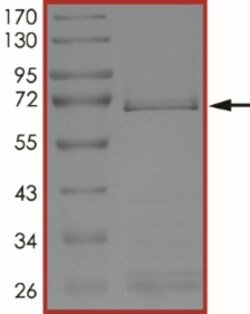 Sino Biological&nbsp;Recombinant Human FGFR3 Protein (d613-653, GST Tag)