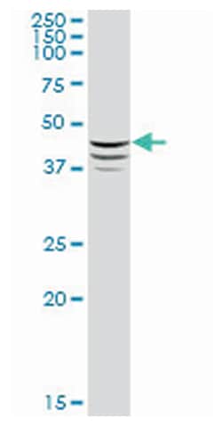 adipose differentiation-related protein, Mouse, Purified MaxPab&trade; Polyclonal Antibody, Abnova&trade;