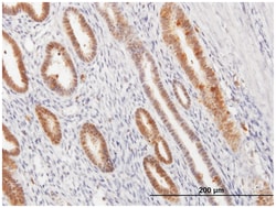 annexin A1, Mouse, Purified MaxPab Polyclonal Antibody, Abnova 50&mu;g;