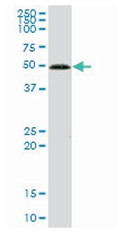 glucokinase (hexokinase 4), Mouse, Purified MaxPab Polyclonal Antibody,