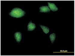 glucokinase (hexokinase 4), Mouse, Purified MaxPab Polyclonal Antibody,