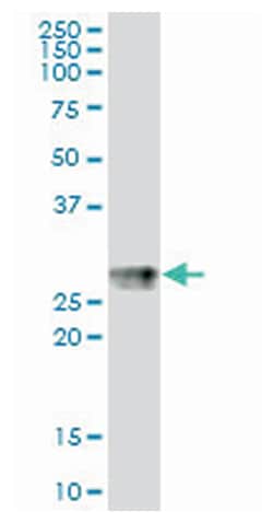 major histocompatibility complex, class II, DP beta 1, Mouse, Purified