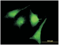 mitogen-activated protein kinase kinase 2, Rabbit, Purified MaxPab Polyclonal Antibody, Abnova 100 &mu;g | Buy Online | Abnova | Fisher Scientific