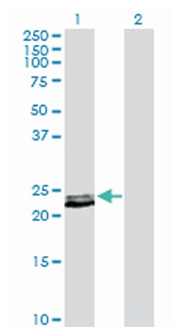 prolactin, Rabbit, Purified MaxPab™ Polyclonal Antibody, Abnova™